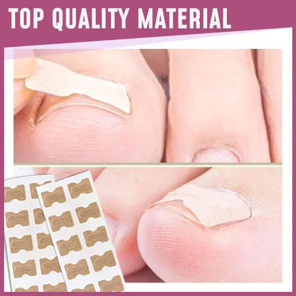 Lighteme Toenail Corrector Patches