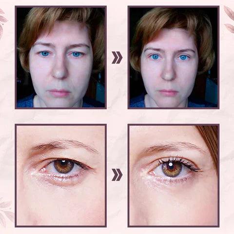 Lighteme Eyelid Sticker incl. FREE tweezers | Eliminate droopy eyelids in seconds